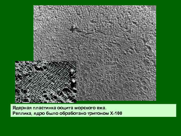 Ядерная пластинка ооцита морского ежа. Реплика, ядро было обработано тритоном Х-100 