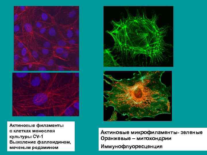 Актиновые филаменты в клетках монослоя культуры CV-1 Выявление фаллоидином, меченым родамином Актиновые микрофиламенты- зеленые