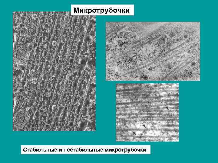 Микротрубочки Стабильные и нестабильные микротрубочки 