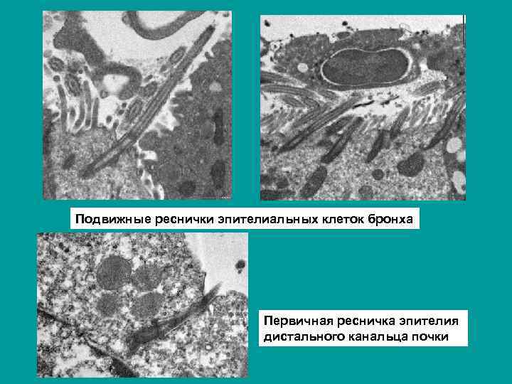 Подвижные реснички эпителиальных клеток бронха Первичная ресничка эпителия дистального канальца почки 