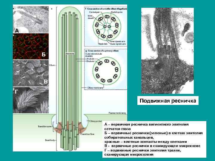 А Б В Г Подвижная ресничка А – первичная ресничка пигментного эпителия сетчатки глаза