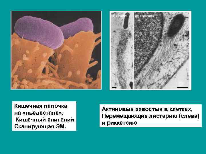 Кишечная палочка на «пьедестале» . Кишечный эпителий Сканирующая ЭМ. Актиновые «хвосты» в клетках, Перемещающие