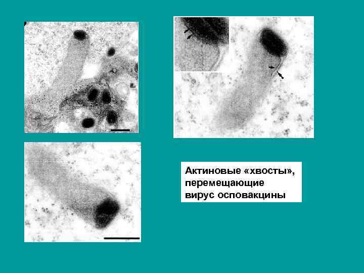 Актиновые «хвосты» , перемещающие вирус осповакцины 