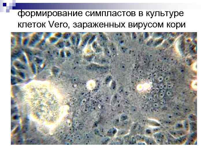 формирование симпластов в культуре клеток Vero, зараженных вирусом кори 