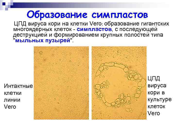 Образование симпластов ЦПД вируса кори на клетки Vero: образование гигантских многоядерных клеток - симпластов,