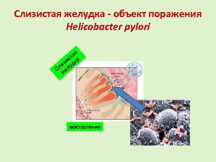Слизистая желудка - объект поражения Нelicobacter pylori я та с а зи дк ли
