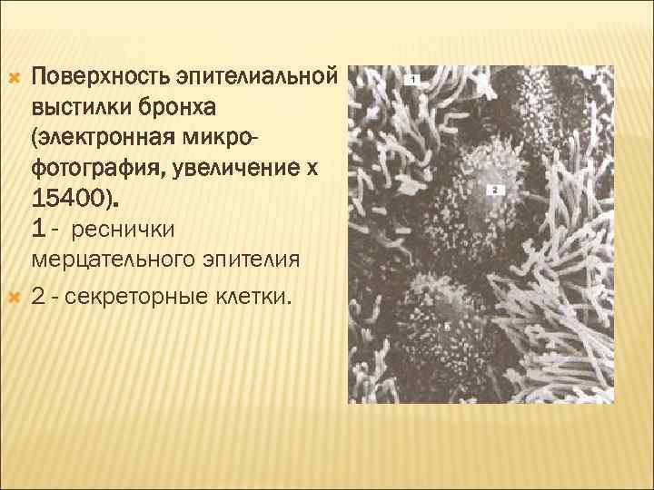  Поверхность эпителиальной выстилки бронха (электронная микрофотография, увеличение х 15400). 1 - реснички мерцательного