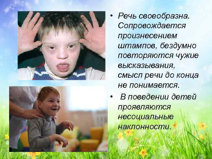  • Речь своеобразна. Сопровождается произнесением штампов, бездумно повторяются чужие высказывания, смысл речи до