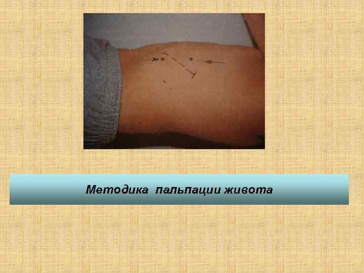 Методика пальпации живота 