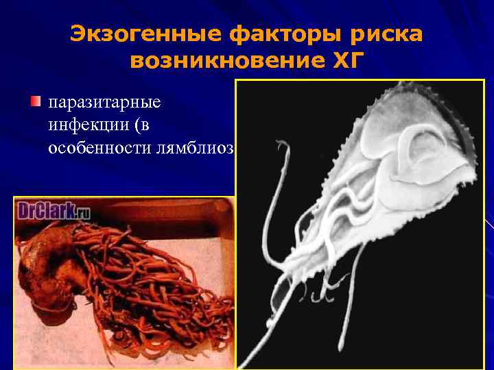 Экзогенные факторы риска возникновение ХГ паразитарные инфекции (в особенности лямблиоз 