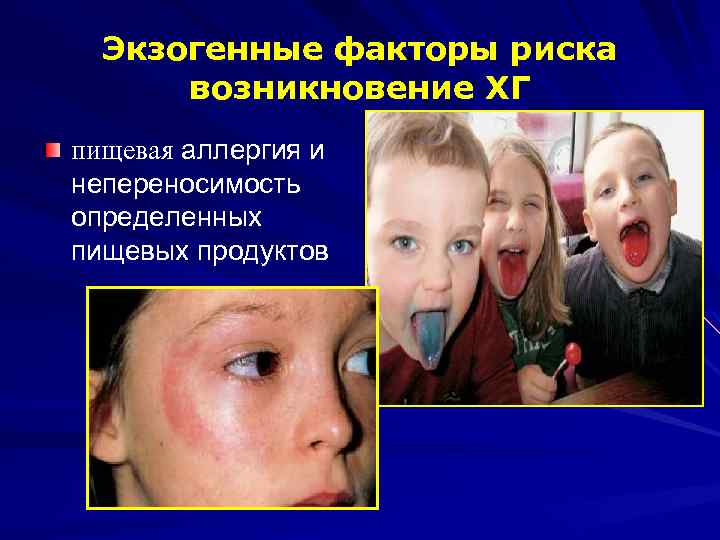 Экзогенные факторы риска возникновение ХГ пищевая аллергия и непереносимость определенных пищевых продуктов 