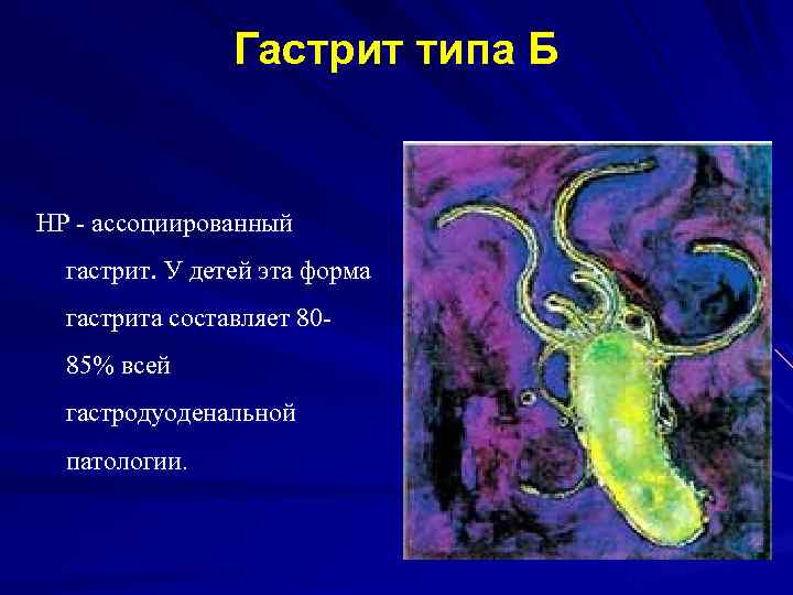 Гастрит типа Б HP - ассоциированный гастрит. У детей эта форма гастрита составляет 8085%