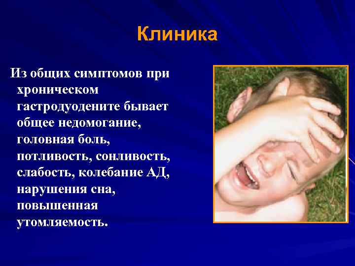 Клиника Из общих симптомов при хроническом гастродуодените бывает общее недомогание, головная боль, потливость, сонливость,