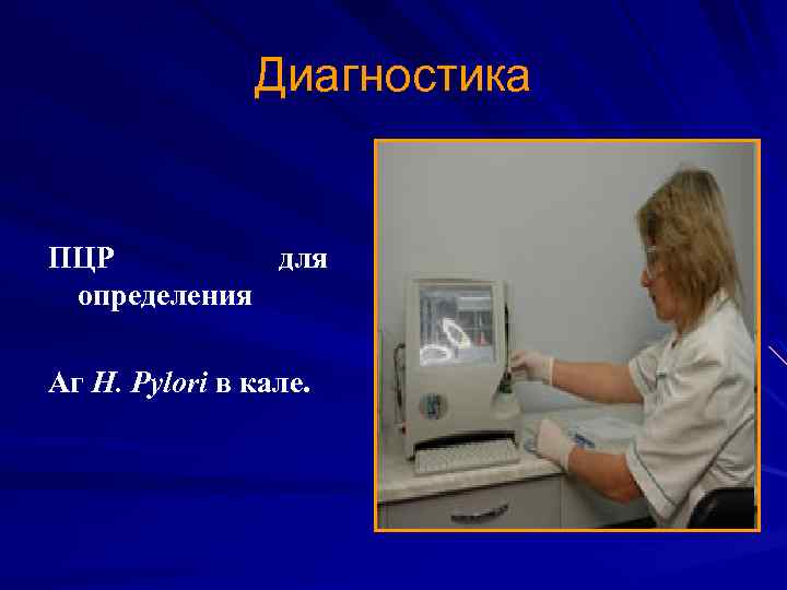 Диагностика ПЦР для определения Аг H. Pylori в кале. 