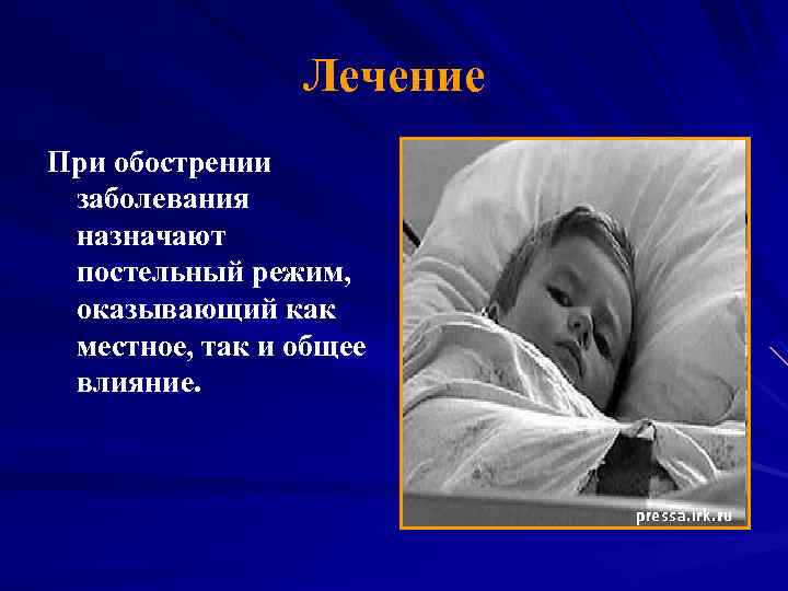Лечение При обострении заболевания назначают постельный режим, оказывающий как местное, так и общее влияние.