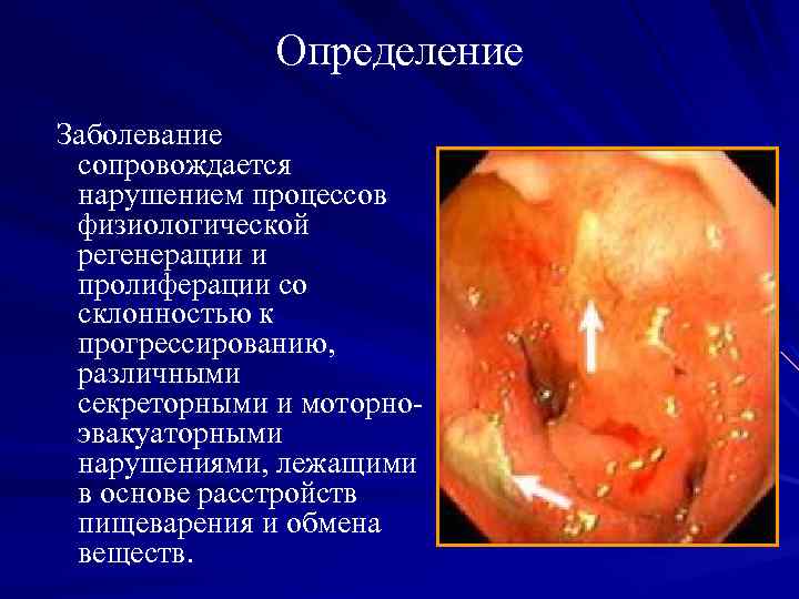 Определение Заболевание сопровождается нарушением процессов физиологической регенерации и пролиферации со склонностью к прогрессированию, различными