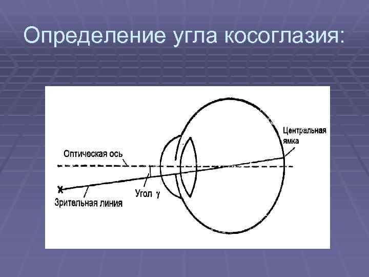 Определение угла косоглазия: 