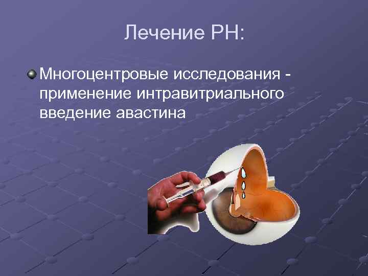 Лечение РН: Многоцентровые исследования применение интравитриального введение авастина 