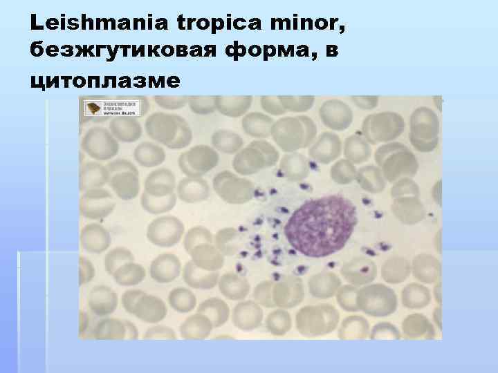 Leishmania tropica minor, безжгутиковая форма, в цитоплазме 