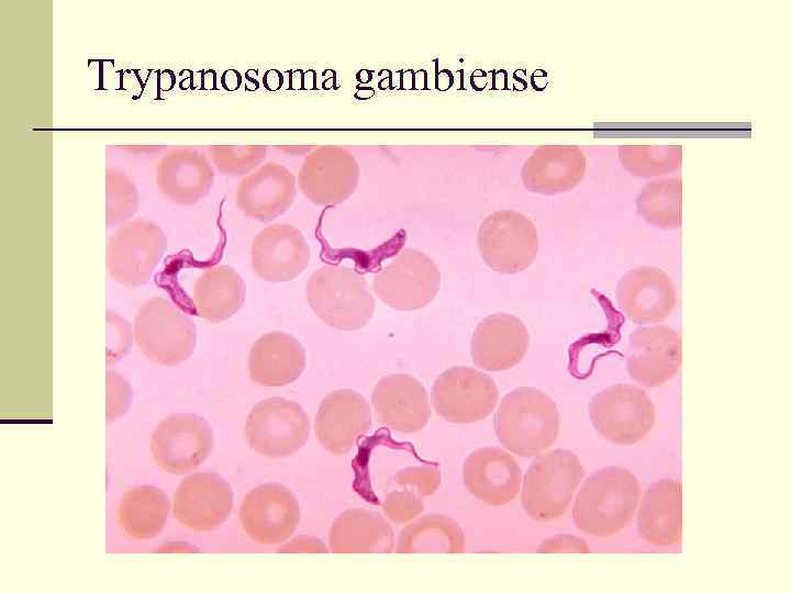 Trypanosoma gambiense 