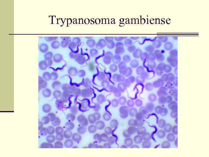 Trypanosoma gambiense 