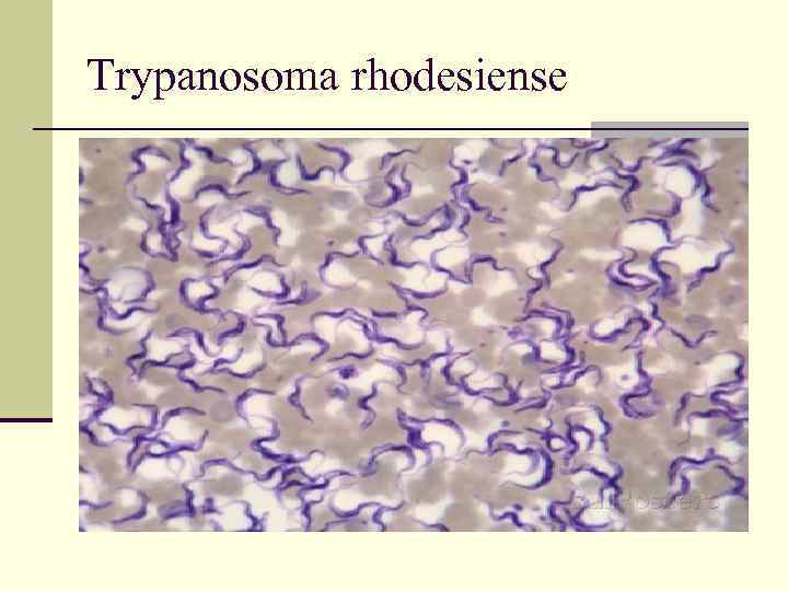 Trypanosoma rhodesiense 