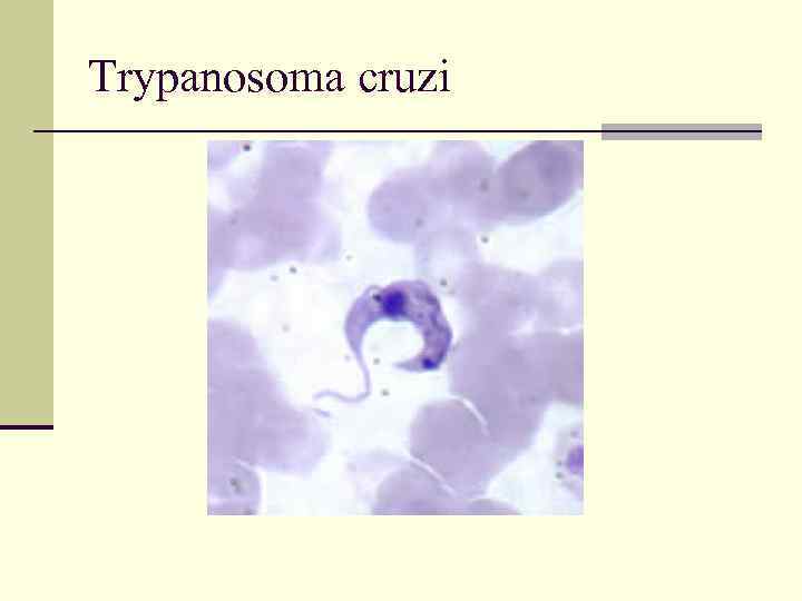 Trypanosoma cruzi 