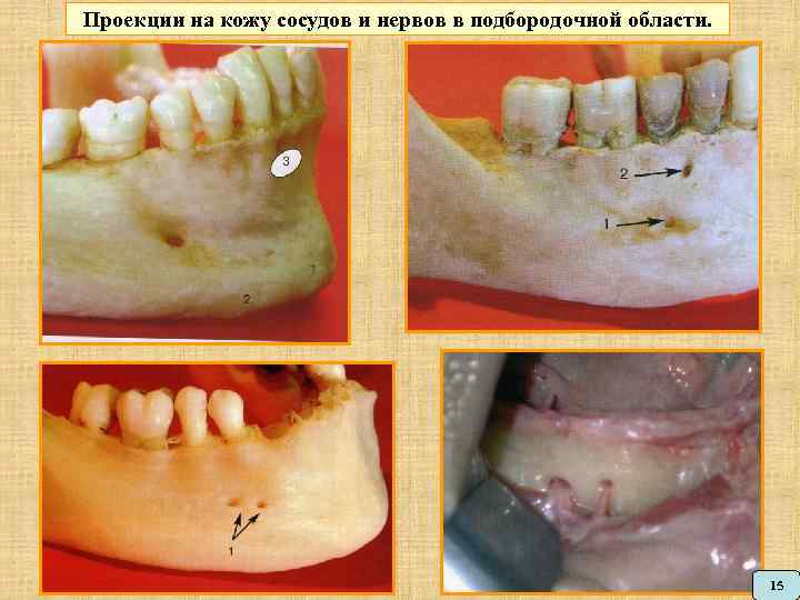 Проекции на кожу сосудов и нервов в подбородочной области. Копылова, И. А. Строение нижнечелюстного