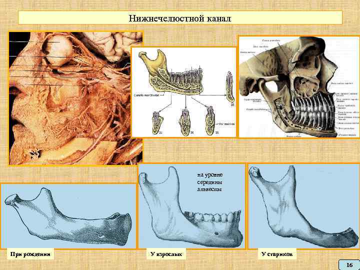 Нижнечелюстной канал на уровне середины альвеолы При рождении У взрослых У стариков 16 