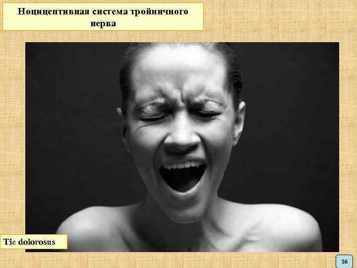 Ноцицептивная система тройничного нерва Tic dolorosus 26 