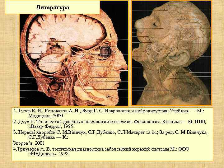 Литература 1. Гусев Е. И. , Коновалов А. Н. , Бурд Г. С. Неврология