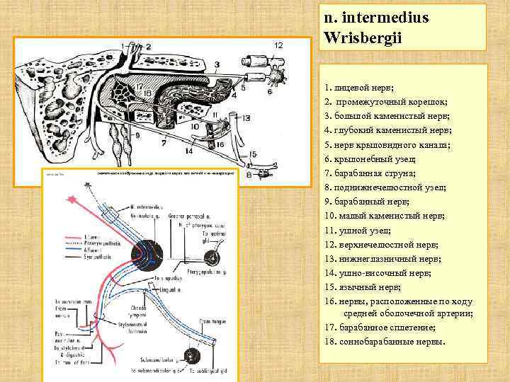 n. intermedius Wrisbergii 1. лицевой нерв; 2. промежуточный корешок; 3. большой каменистый нерв; 4.