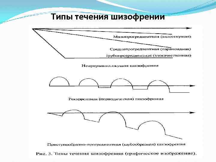 Типы течения шизофрении 