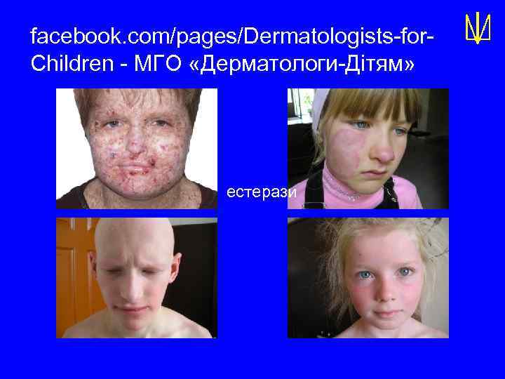 facebook. com/pages/Dermatologists-for. Children - МГО «Дерматологи-Дітям» естерази 