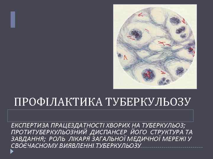 ПРОФІЛАКТИКА ТУБЕРКУЛЬОЗУ ЕКСПЕРТИЗА ПРАЦЕЗДАТНОСТІ ХВОРИХ НА ТУБЕРКУЛЬОЗ; ПРОТИТУБЕРКУЛЬОЗНИЙ ДИСПАНСЕР ЙОГО СТРУКТУРА ТА ЗАВДАННЯ; РОЛЬ