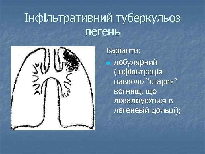 Інфільтративний туберкульоз легень Варіанти: n лобулярний (інфільтрація навколо “старих” вогнищ, що локалізуються в легеневій