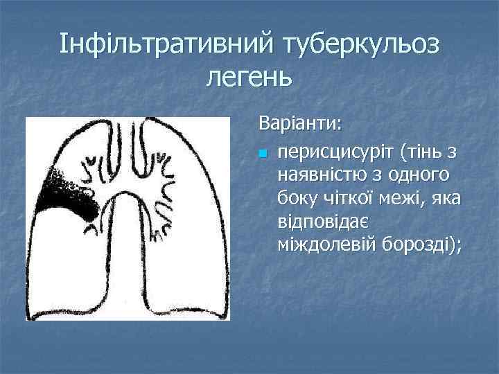 Інфільтративний туберкульоз легень Варіанти: n перисцисуріт (тінь з наявністю з одного боку чіткої межі,