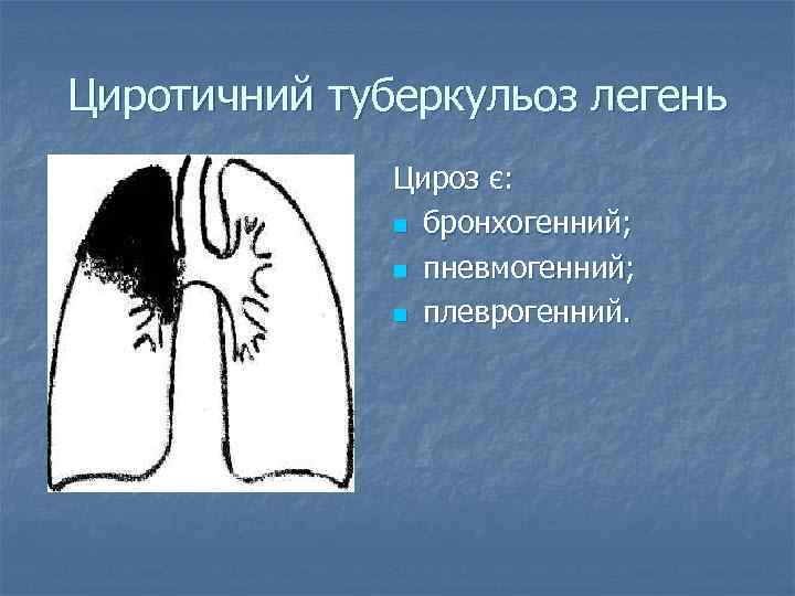 Циротичний туберкульоз легень Цироз є: n бронхогенний; n пневмогенний; n плеврогенний. 