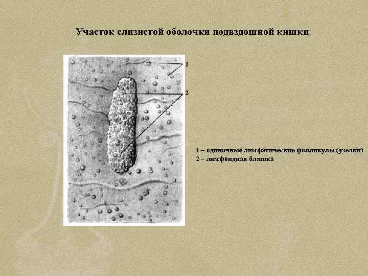 Участок слизистой оболочки подвздошной кишки 1 2 1 – одиночные лимфатические фолликулы (узелки) 2