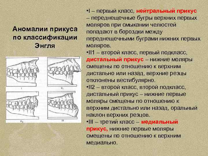 Аномалии прикуса по классификации Энгля • I – первый класс, нейтральный прикус – переднещечные