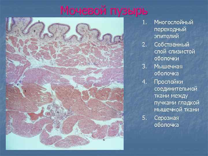 Стенка мочевого