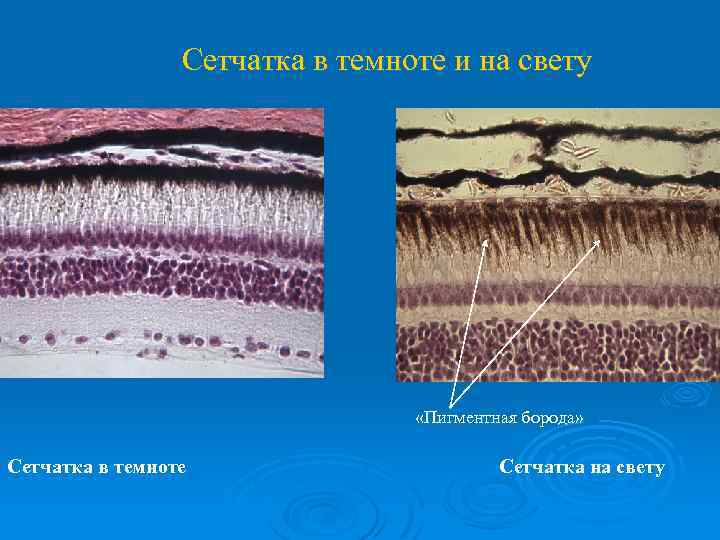 Сетчатка в темноте и на свету «Пигментная борода» Сетчатка в темноте Сетчатка на свету