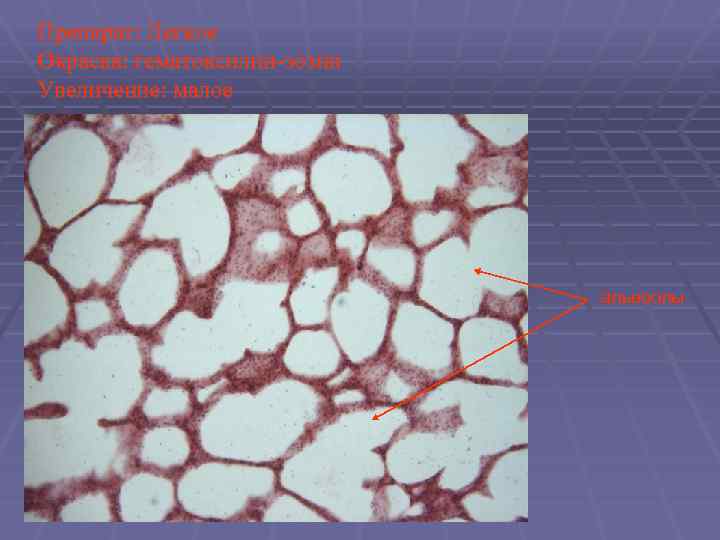Препарат: Легкое Окраска: гематоксилин-эозин Увеличение: малое альвеолы 