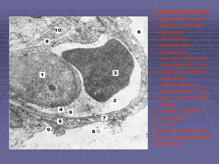 Электронограмма: 1 – ядро эндотелиоцита 2 – просвет капилляра 3 – эритроцит 4 –