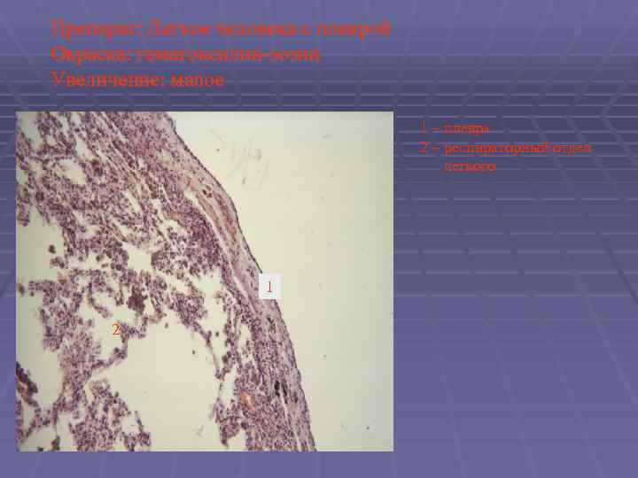 Препарат: Легкое человека с плеврой Окраска: гематоксилин-эозин Увеличение: малое 1 – плевра 2 –