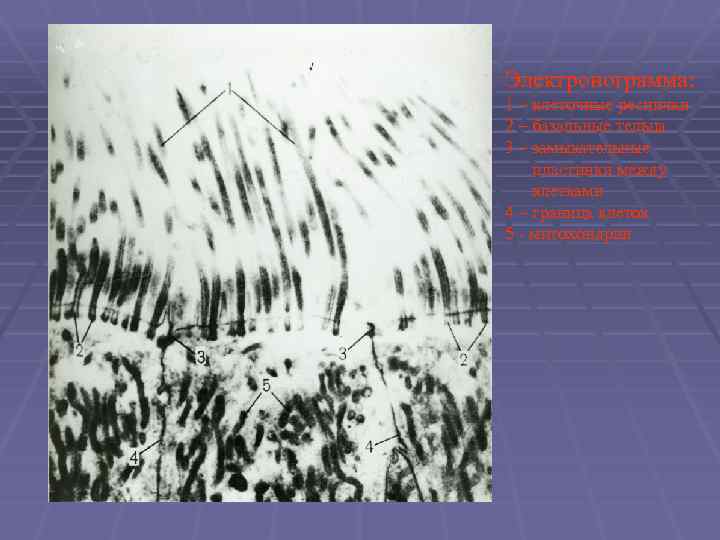 Электронограмма: 1 – клеточные реснички 2 – базальные тельца 3 – замыкательные пластинки между