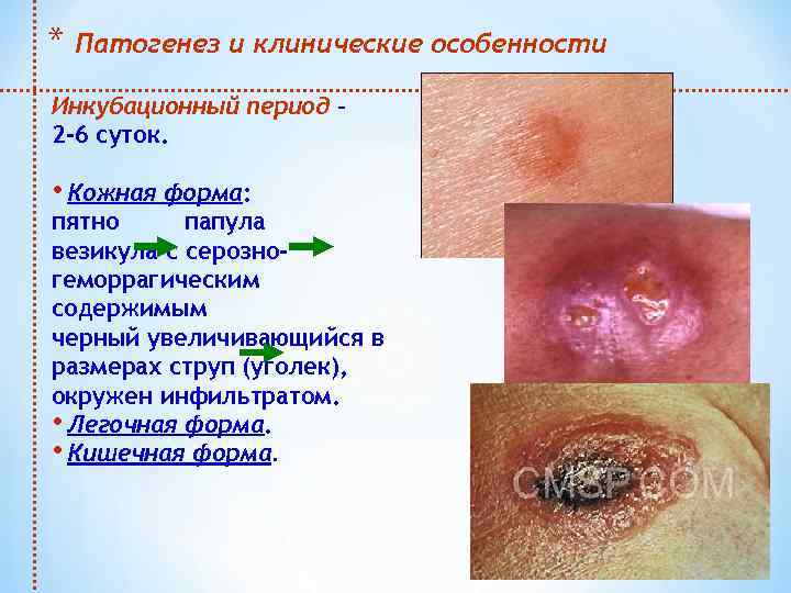 * Патогенез и клинические особенности Инкубационный период – 2 -6 суток. • Кожная форма: