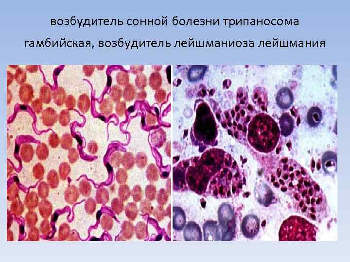 возбудитель сонной болезни трипаносома гамбийская, возбудитель лейшманиоза лейшмания 