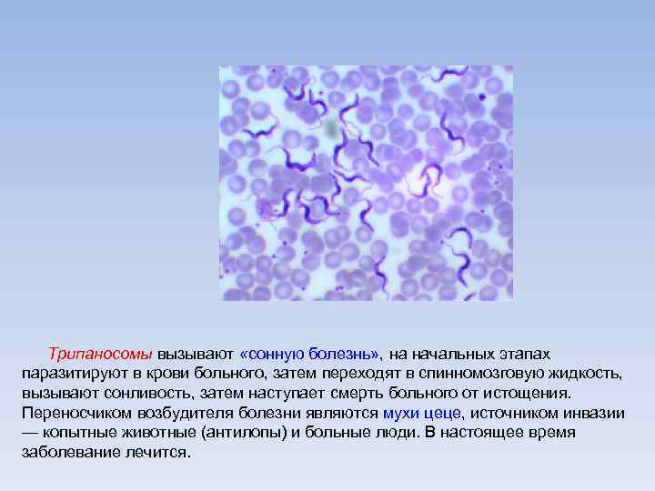 Трипаносомы вызывают «сонную болезнь» , на начальных этапах паразитируют в крови больного, затем переходят