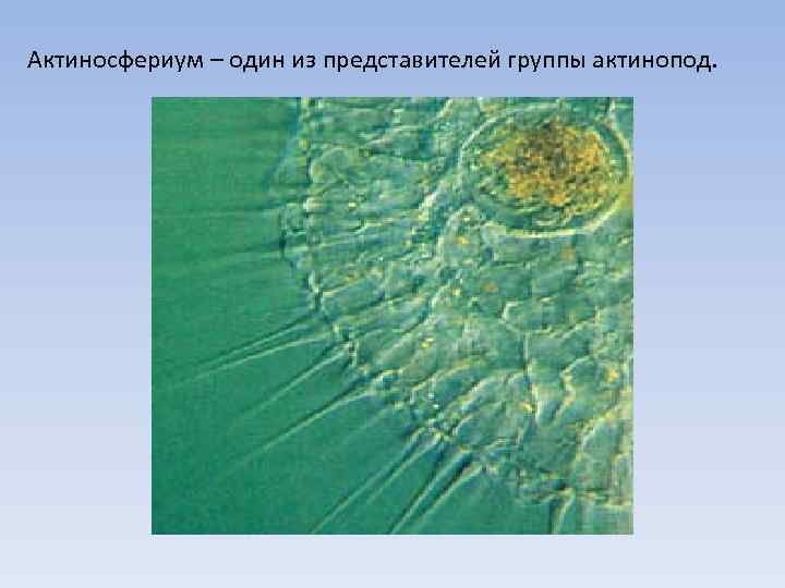 Актиносфериум – один из представителей группы актинопод. 